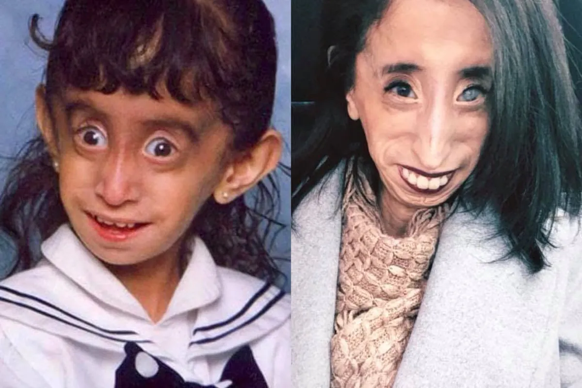 Lizzie Velasquez erhält Todesdrohung: „Ich werde nicht schweigen“