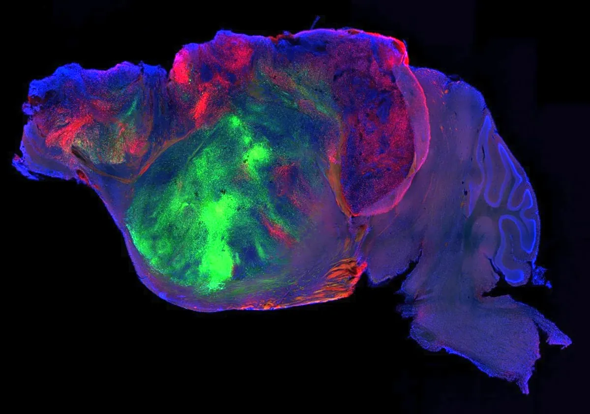 Menschliche Neuronen in Mäusegehirne integriert: Ein Erfolg